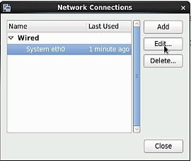 manage network interface